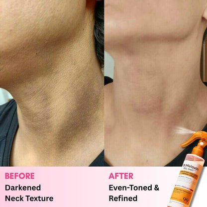 Dr. Melaxin Peel Shot: Brightening Body Spray
