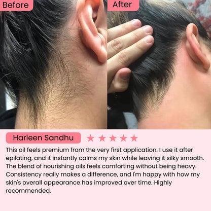 Cyperus Rotundus Hair Reduction Oil